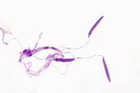 Grenouille - Spermatozoïdes x400